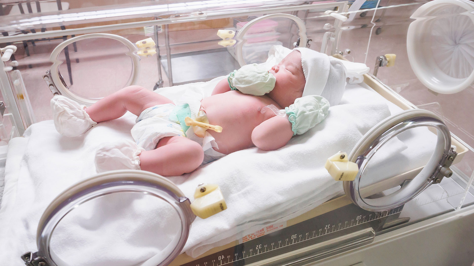 Deficiências evitáveis: ​como a atenção neonatal pode evitar sequelas neurológicas graves