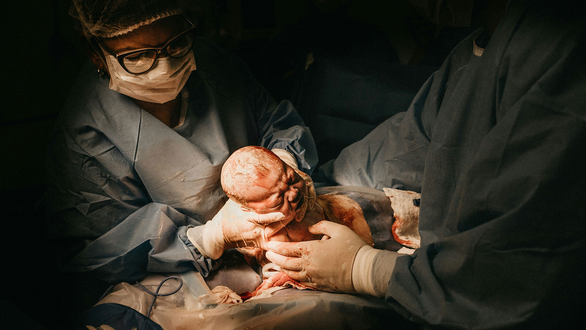 Asfixia perinatal atinge 10% ​dos nascimentos no Brasil